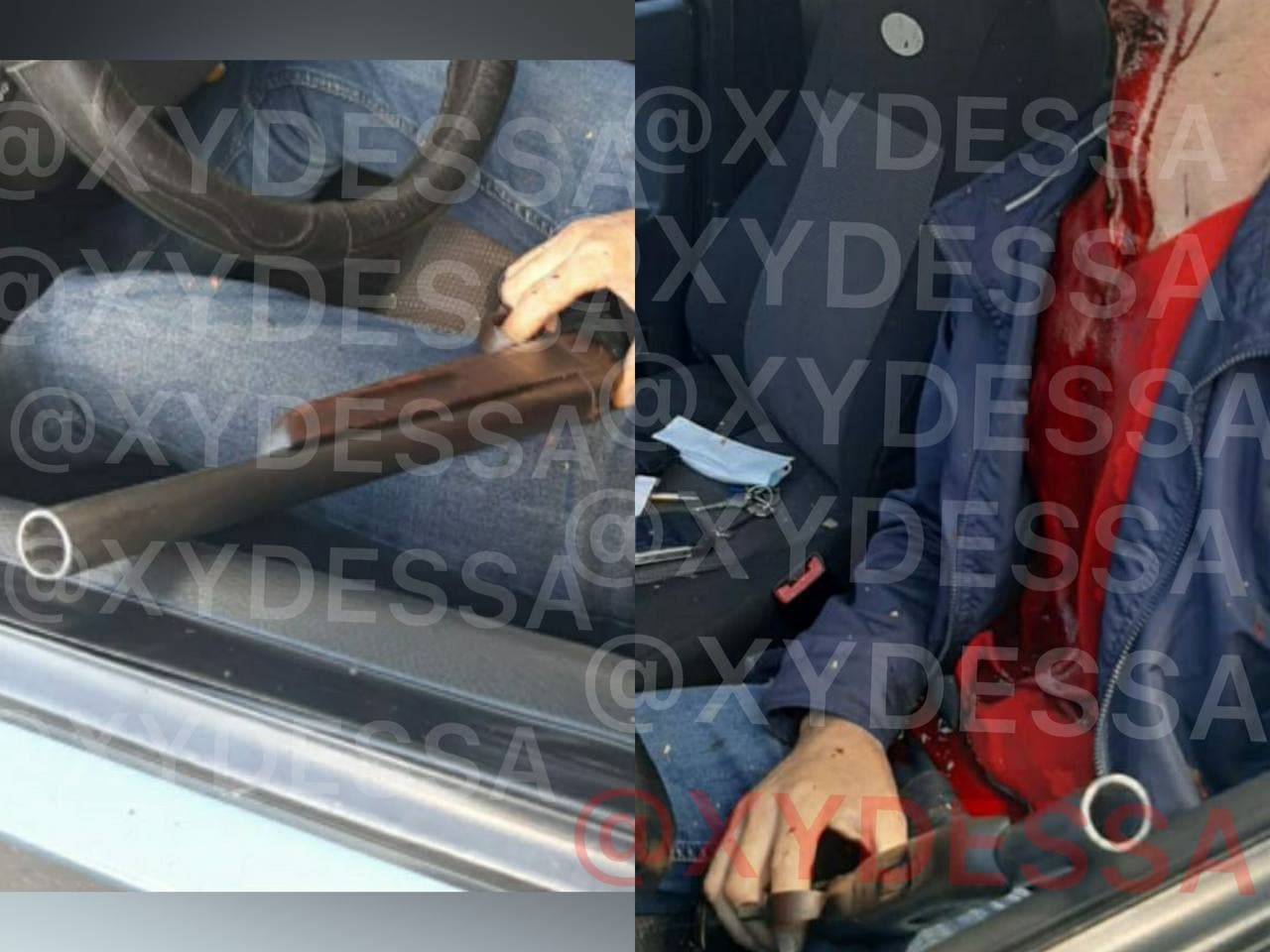 В Измаиле мужчина пообещал жене сюрприз и выстрелил себе в голову из ружья (фото) - 1 - изображение qkeideuidqridrkmp